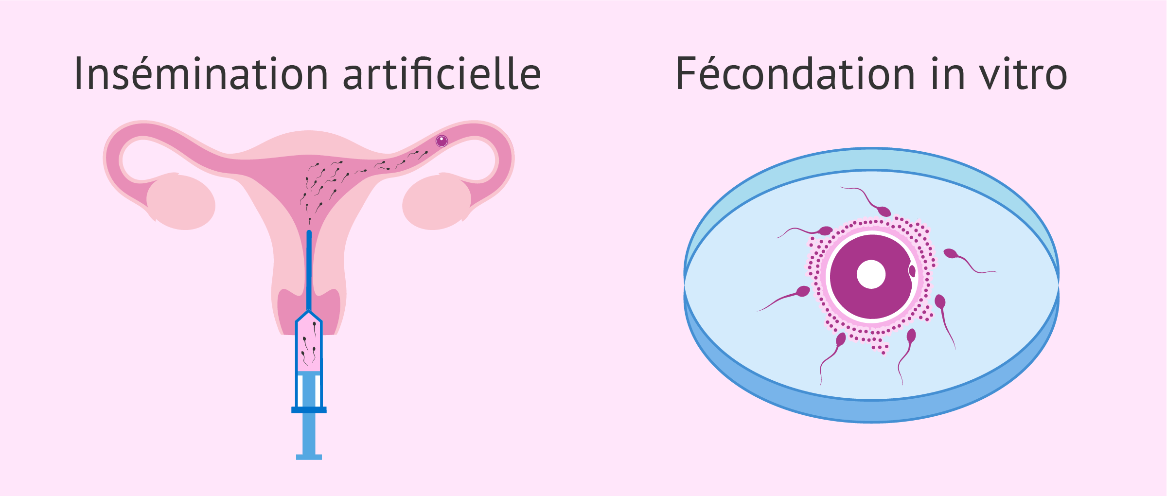 Différence entre insémination artificielle et FIV : Blog CMT