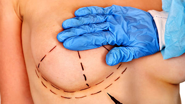 chirurgie-esthetique-seins