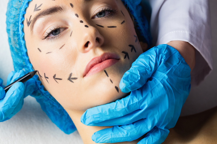 chirurgie-esthetique-visage